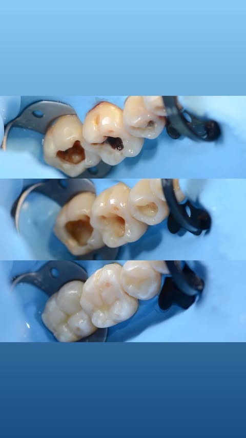 До/После: реставрация