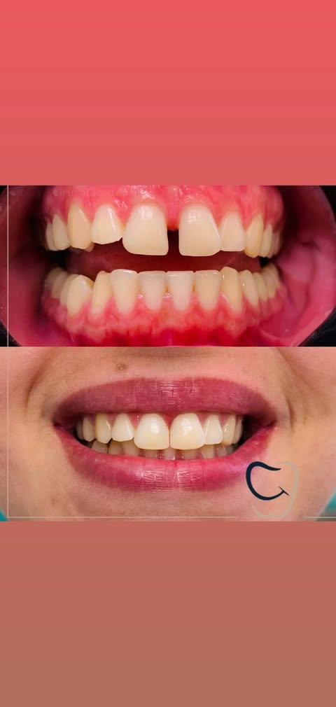 Ортодонтия