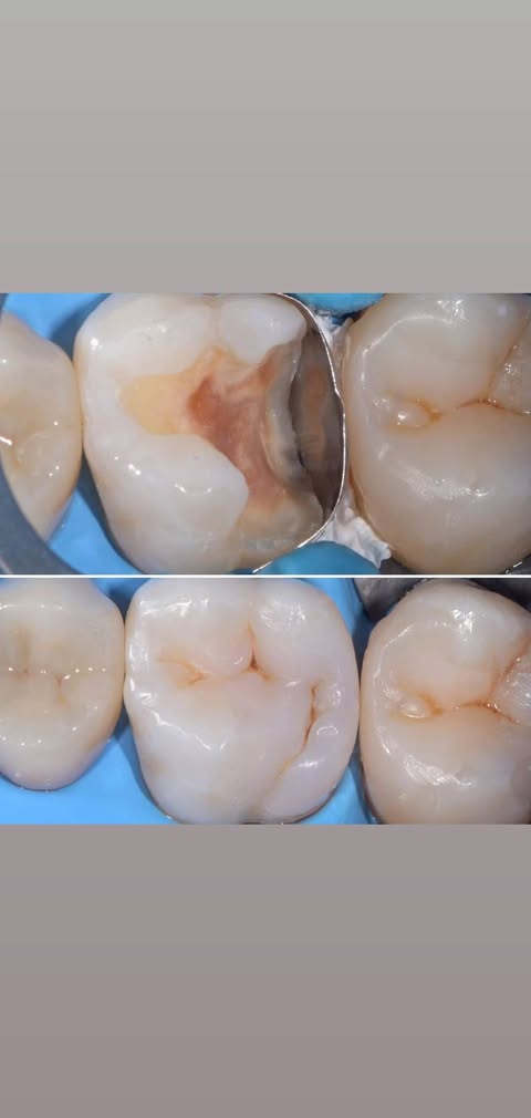 До/После: стоматологическая работа
