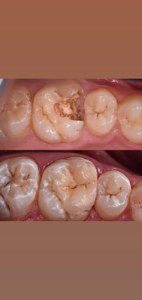 До/После: лечение