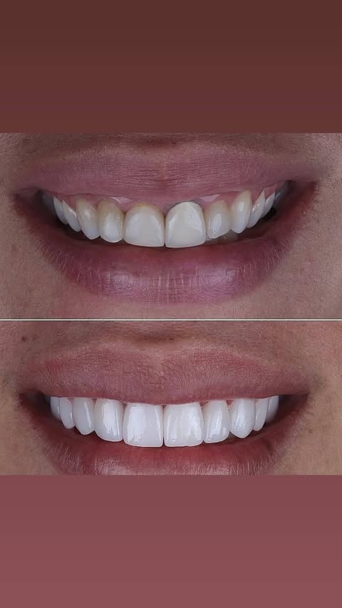 До/После: эстетика