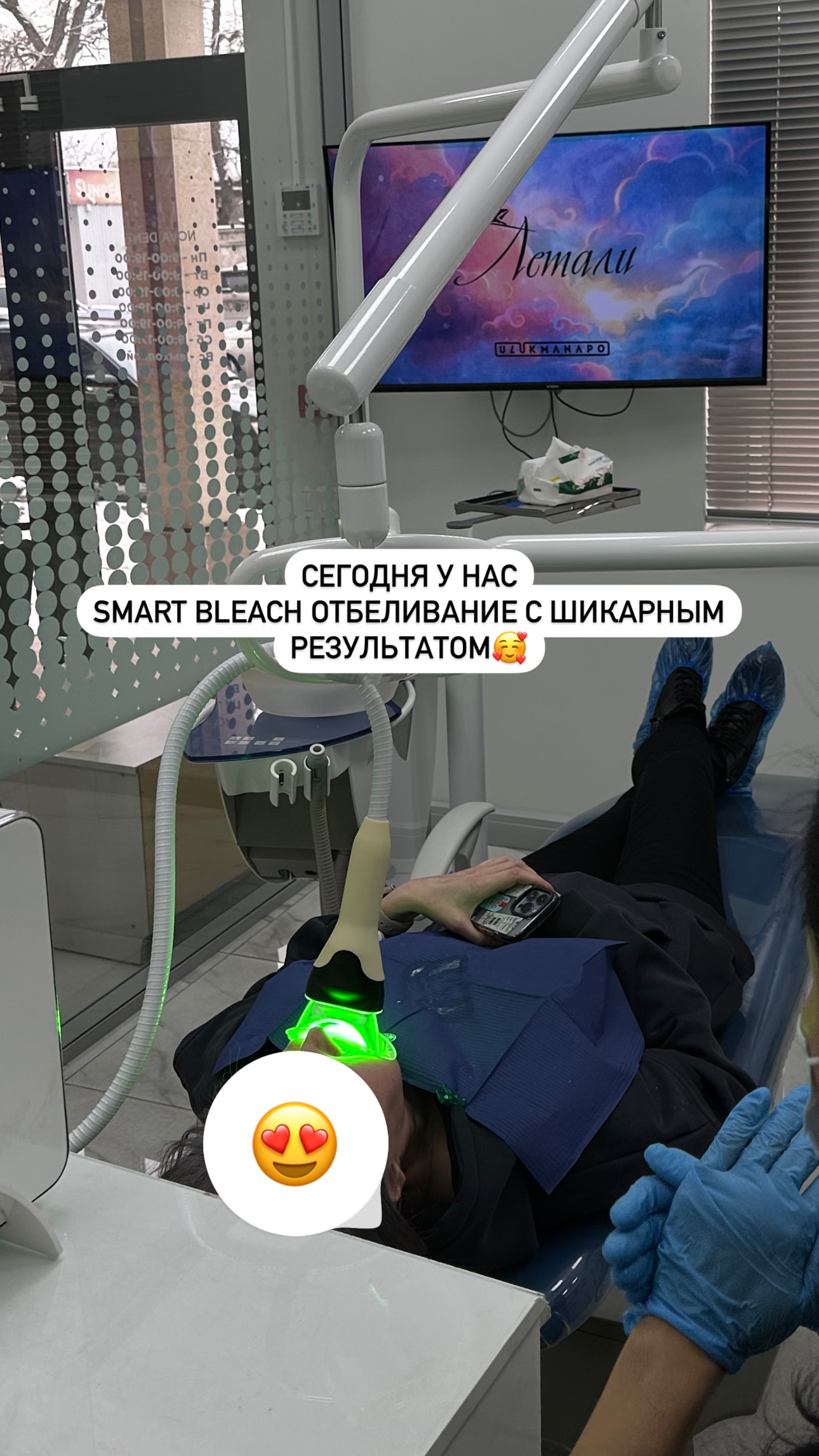 Отбеливание зубов