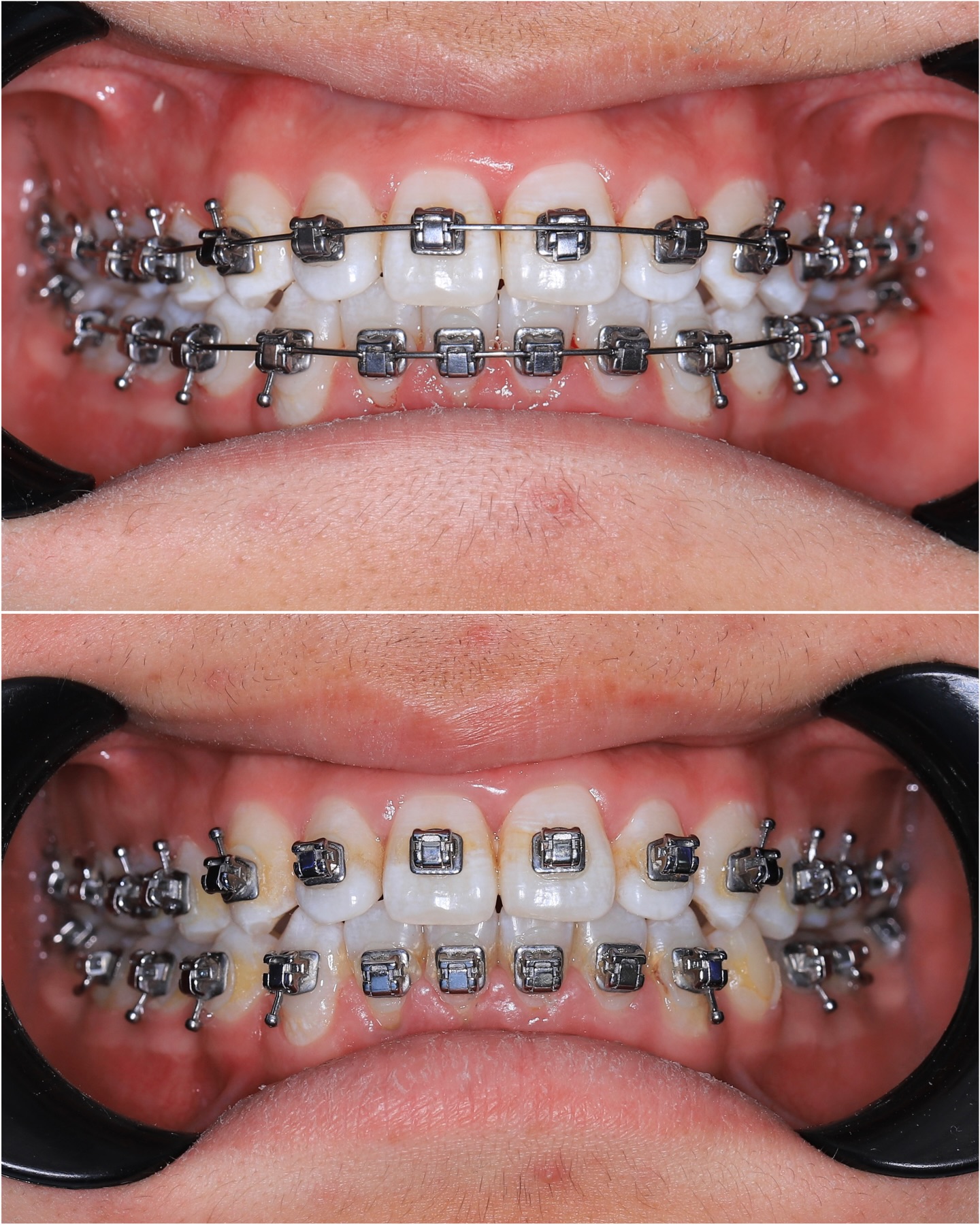 Профессиональная чистка